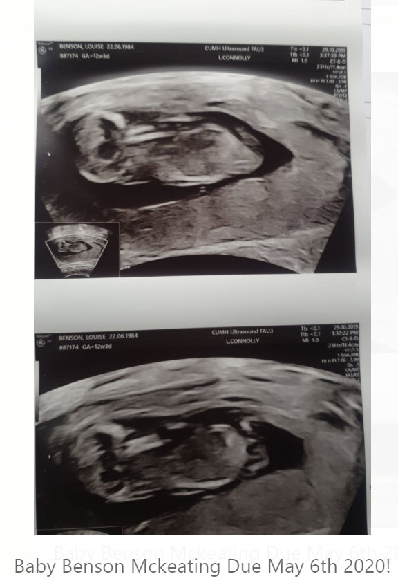 Baby Benson McKeating due May 2020